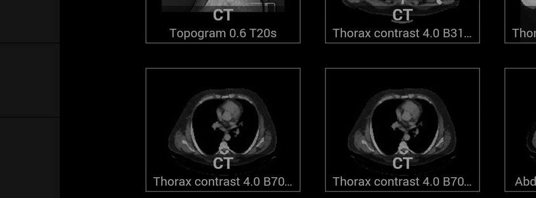 Sqilline’s SMART DI medical imaging application boosts real-time collaboration…