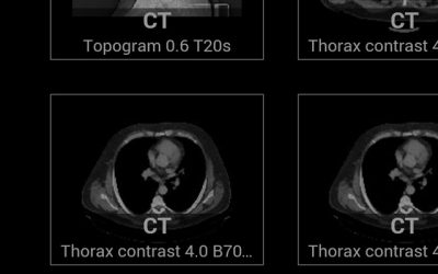 Sqilline’s SMART DI medical imaging application boosts real-time collaboration…