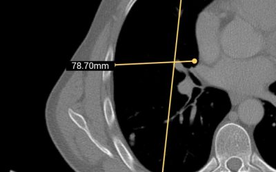 Sqilline launched an application for Diagnostic Imaging